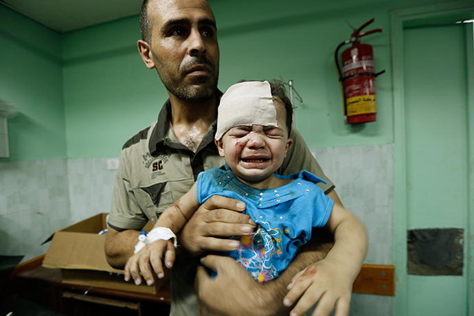 A Palestinian child, wounded in an Israeli strike on a compound housing a UN school in Jabalia refugee camp in the northern Gaza Strip, receives treatment at Kamal Adwan hospital in Beit Lahia early on July 30, 2014 (AFP Photo / Mohammed Abed)
